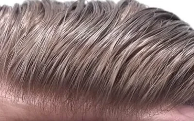 Pánské vlasové systémy. Vlasové náhrady mají svá pro i proti