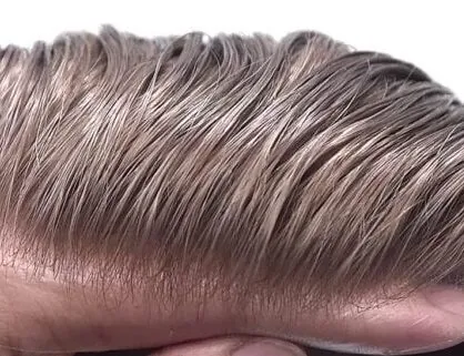 Detail vlasové linie pánského vlasového systému V-Loop hair